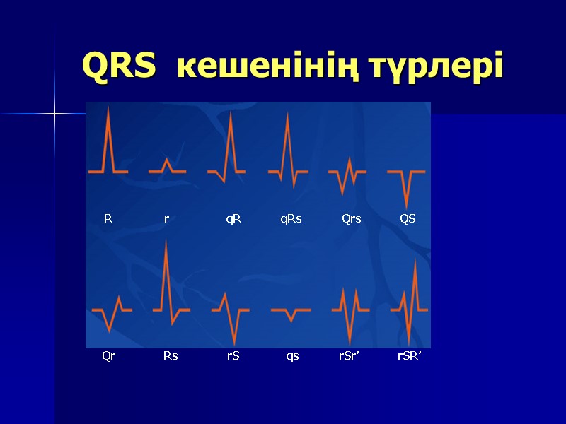 QRS  кешенінің түрлері